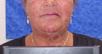 ELVIRA NMI RHYNE | 2019-05-06 12:55:00 Saline County, Missouri Booking