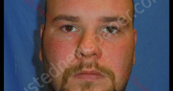 MATTHEW W. LINDSAY | 2020-01-22 13:04:00 Henry County, Missouri Booking