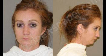TURNER, <B>JESSICA</B> MARIE #, <b>Denton</b> County, Texas, Denton County, Texas - 2020-02-13