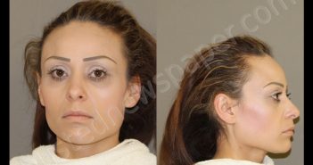 <B>REZA</B>, <B>JESSICA</B> <B>RENEE</B> #, Denton County, Texas - 2020-03-10