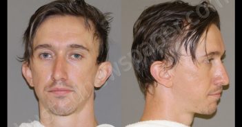 <B>ALBRECHT</B>, <B>TROY</B> <B>ALLEN</B> #, Denton County, Texas - 2020-03-30