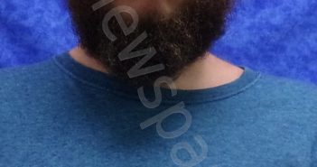 DANIEL SCOTT ARNOLD | 2020-07-26 16:20:00 Saline County, Missouri Booking