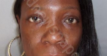 MADISON, CYNTHIA A | 2020-07-29 11:06:00 Jefferson County, Alabama Booking