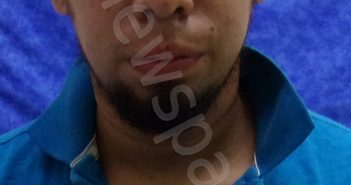 HEVER MARCELINO FIGUEROA BARDAL | 2020-08-17 00:04:00 Saline County, Missouri Booking