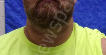 JEREMY ACE WOODS | 2020-09-17 18:16:00 Saline County, Missouri Booking