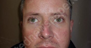 GRAY, RANDALL PATRICK | 2021-03-02 17:04:00 Jefferson County, Alabama Booking