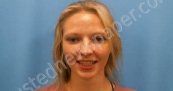 KATILYN PORTER | 2022-07-01 20:31:00 Franklin County, Alabama Booking