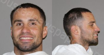 <B>ORTIZ</B>–<B>ROSADO</B>, <B>GIOVANNI</B> #, Denton County, Texas - 2023-03-11