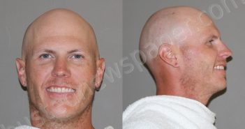 <B>BANNISTER</B>, <B>JUSTIN</B> <B>LOGAN</B> #, Denton County, Texas - 2023-06-12
