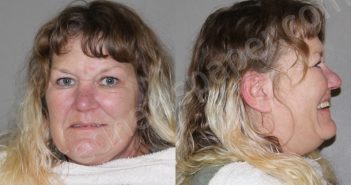 SPEER, STEPHANI DIONE | 2024-04-09 Denton County, Texas Booking