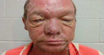 <B>BRUMMETT</B>, <B>THOMAS</B> <B>DEWAYNE</B> #, Brown County, Texas - 2024-08-30 20:12:00