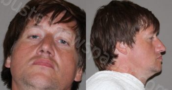 <B>EASTER</B>, <B>KEVIN</B> COLLINS #, Denton County, Texas - 2024-10-11