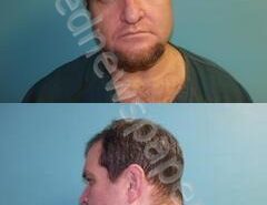 YOUNG, JAMES ALLEN | 2025-01-03 12:29:00 Aransas County, Texas Booking