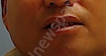 MEDINA, JONY PATRICIO | 2026-01-08 22:53:00 Calhoun County, Arkansas Booking